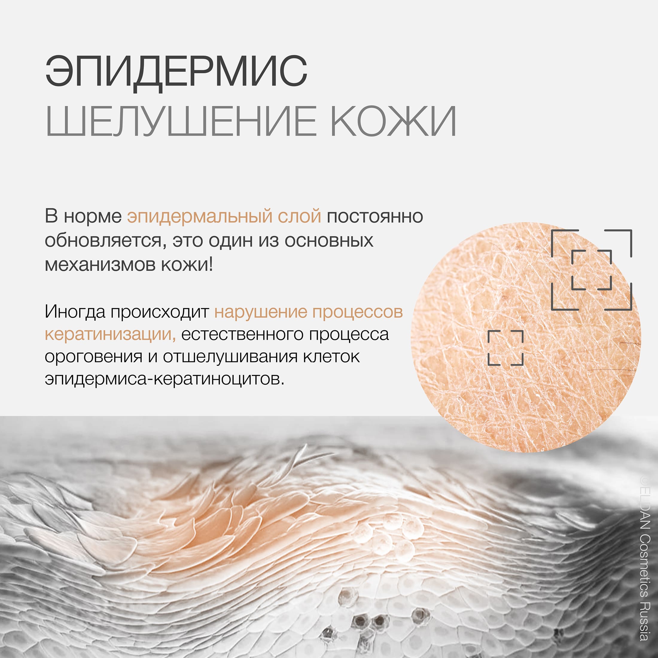 Пост шелушение 2.jpg